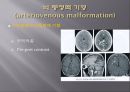 Brain CT에 관한 PPT 9페이지