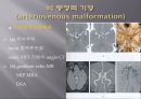Brain CT에 관한 PPT 10페이지