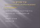 Brain CT에 관한 PPT 13페이지