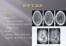 Brain CT에 관한 PPT 15페이지