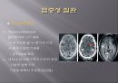 Brain CT에 관한 PPT 17페이지