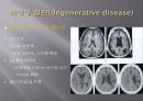 Brain CT에 관한 PPT 18페이지