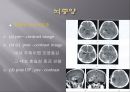Brain CT에 관한 PPT 22페이지