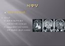Brain CT에 관한 PPT 24페이지