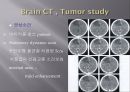 Brain CT에 관한 PPT 33페이지