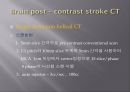 Brain CT에 관한 PPT 35페이지