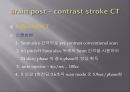 Brain CT에 관한 PPT 37페이지