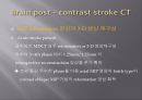 Brain CT에 관한 PPT 41페이지