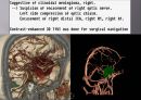 Brain CT에 관한 PPT 48페이지