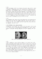 case NS SDH Closed Traumatic SDH(subdural hemorrhage) 경막하혈종 A+ 4페이지