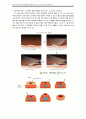 [성인간호학A＋] 위전절제술 대상자의 수술 간호 CASE STUDY 10페이지
