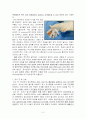 Bone Marrow Biopsy, 골수검사, NHL(Non-Hodgkins lymphoma) 케이스 스터디 4페이지