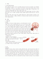 [추천] cerebral infarction 뇌경색 간호과정(Cerebral infarction, 뇌경색 케이스 스터디, 뇌경색 간호과정, 뇌경색 간호진단, 뇌졸중 케이스, 뇌졸중 간호과정) 2페이지