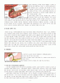 CBD stone 담석증 A+ 교수님이 예문사용한다하심 (담석증 케이스, 담석 케이스 스터디, CBD stone 케이스 스터디, gallstone 사례연구, 담석 간호과정, 담석증 사례연구) 4페이지