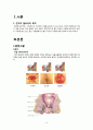 치질 Hemorrhoid - 치질 케이스 스터디, 치질 case study, 치질 간호과정, 치질 간호진단, Hemorrhoid case, Hemorrhoid 사례연구 3페이지