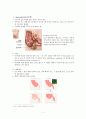 Appendicitis (충수염) 2페이지