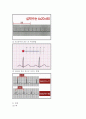 심전도(EKG)의 기본원리 6페이지