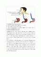 식도정맥류(esophageal varix) 간호 9페이지
