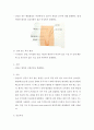 탈장(hernia) 간호 4페이지