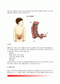영아기의 소화기 질환(영아의 산통, 설사, 성장장애, 장중첩증) - 영아기 소화기계질환의 원인과 증상 및 치료방법 7페이지