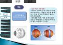 망막장애 대상자 병태생리, 간호 10페이지