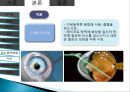 망막장애 대상자 병태생리, 간호 19페이지