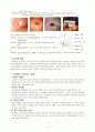 breast cancer case study 2페이지