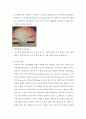 대상포진 간호 4페이지