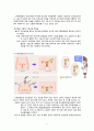 자궁근종 문헌고찰 10페이지