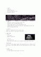 초음파 검사(심장, 뇌, 갑상선 외 6가지)에 대해 모두 공부할 수 있는 자료! 만점자부하는 자료! A+보장하는 자료! 7페이지