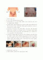 장루간호(수술전,수술후,종류) 10페이지