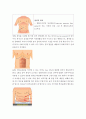 장루간호(수술전,수술후,종류) 13페이지