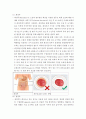 장루간호(수술전,수술후,종류) 16페이지