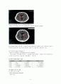 CVA case study 5페이지