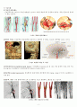 뇌졸중 문헌고찰 내용 정리 6페이지