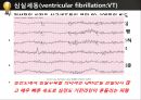 [PPT] 병원 현장에서의 심폐소생술 26페이지