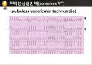 [PPT] 병원 현장에서의 심폐소생술 27페이지