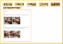 신생아황달자료 32페이지