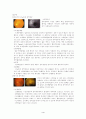당뇨병성 망막증 케이스 (당뇨병성 망막증 케이스 당뇨병성 망막증 CASE STUDY 망막증 CASE 간호과정) 4페이지