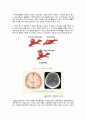 지주막하 출혈(Subarachnoid hemorrhage) 케이스 스터디 5페이지