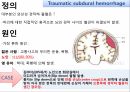 외상성 경막하 출혈 4페이지