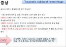 외상성 경막하 출혈 5페이지