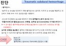 외상성 경막하 출혈 7페이지