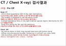 외상성 경막하 출혈 28페이지