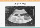 This is 센서다(센서) - 센서란 인간의 오감과 센서와의 관계 18페이지