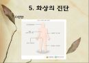 화상 (BURNS) - 화상의 발생빈도 원인 위험요인 진단 종류 10페이지