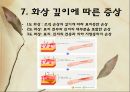 화상 (BURNS) - 화상의 발생빈도 원인 위험요인 진단 종류 18페이지