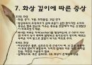 화상 (BURNS) - 화상의 발생빈도 원인 위험요인 진단 종류 22페이지