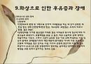 화상 (BURNS) - 화상의 발생빈도 원인 위험요인 진단 종류 28페이지