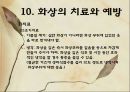 화상 (BURNS) - 화상의 발생빈도 원인 위험요인 진단 종류 32페이지